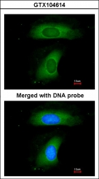 GTX104614 - B-cell linker protein / BLNK