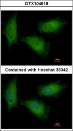 GTX104618 - Triosephosphate isomerase (TPI1)