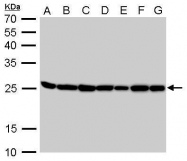 GTX104618 - Triosephosphate isomerase (TPI1)