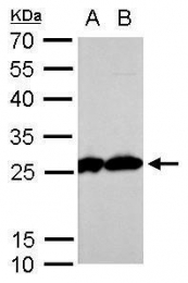 GTX104618 - Triosephosphate isomerase (TPI1)