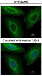 GTX104758 - 14-3-3 protein eta