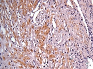 GTX105179 - Isocitrate dehydrogenase / IDH