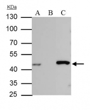 GTX105179 - Isocitrate dehydrogenase / IDH