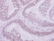 GTX105365 - Unc-51-like kinase 4 (ULK4)