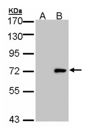 GTX105365 - Unc-51-like kinase 4 (ULK4)