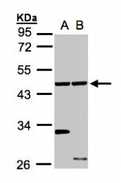 GTX105887 - Ethanolamine kinase 1