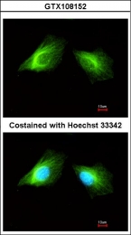 GTX108152 - Histamine H2 receptor