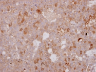 GTX108366 - Beta-1 adrenergic receptor