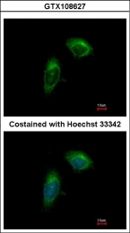 GTX108627 - ZO-1 / Tight junction protein 1