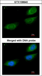 GTX108640 - Fibrinogen gamma chain