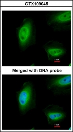 GTX109045 - Tumor protein p73 (TP73)