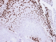GTX109045 - Tumor protein p73 (TP73)