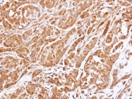 GTX109090 - 14-3-3 protein epsilon
