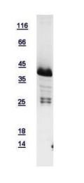 GTX109118-pro - Hepatic leukemia factor / HLF
