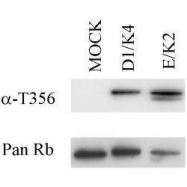 GTX10922 - Retinoblastoma-associated protein / RB1