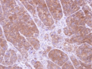 GTX109268 - Tropomyosin-2 (TPM2)