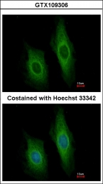 GTX109306 - Deoxyribonuclease-1