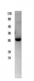GTX109306-pro - Deoxyribonuclease-1