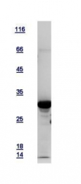 GTX109592-pro - Tropomyosin-3 (TPM3)