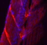 GTX11003 - pan Actin