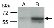 GTX110607 - Estrogen receptor beta