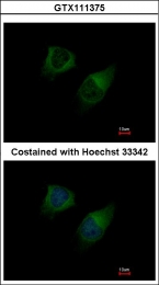 GTX111375 - DAG kinase gamma