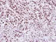 GTX111392 - WEE1 / Wee1-like protein kinase