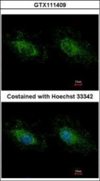 GTX111409 - Hexokinase-3