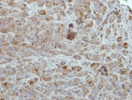 GTX111476 - Unc-51-like kinase 2 (ULK2)