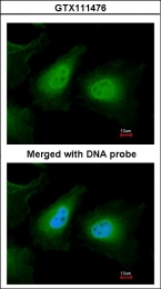 GTX111476 - Unc-51-like kinase 2 (ULK2)
