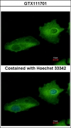GTX111701 - Transglutaminase-2 (TGM2)