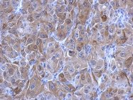 GTX111701 - Transglutaminase-2 (TGM2)