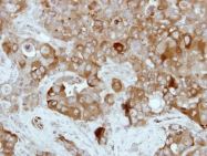 GTX111702 - Transglutaminase-2 (TGM2)