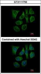 GTX111750 - Galactokinase 2