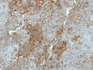 GTX111750 - Galactokinase 2