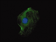 GTX11213 - pan Cytokeratin