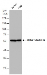 GTX112141 - alpha Tubulin / TUBA4A / TUBA1