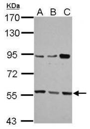 GTX112346 - HMG-CoA synthase / HMGCS