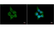 GTX112584 - Hedgehog-interacting protein / HHIP