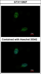 GTX112927 - Estrogen receptor beta