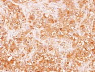 GTX113016 - Tyrosine 3-monooxygenase (TH)