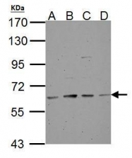 GTX113016 - Tyrosine 3-monooxygenase (TH)