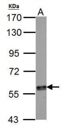 GTX113016 - Tyrosine 3-monooxygenase (TH)