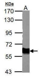 GTX113016 - Tyrosine 3-monooxygenase (TH)