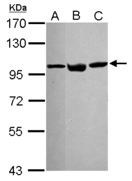 GTX113099 - TER ATPase / VCP