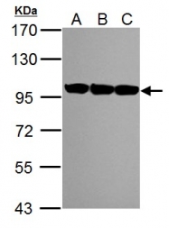 GTX113099 - TER ATPase / VCP