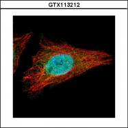 GTX113212 - IRS1