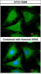 GTX113298 - 14-3-3 protein gamma