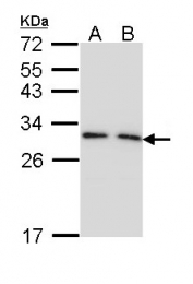 GTX113298 - 14-3-3 protein gamma