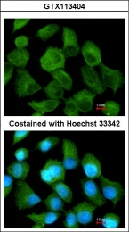 GTX113404 - Tripeptidyl-peptidase 1 (TPP1)